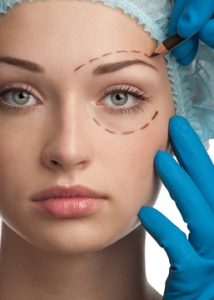 Blepharoplasty (Eyelid Surgery) 