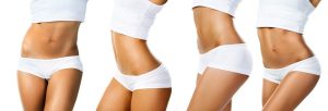 Tummy Tuck | Abdominoplasty | Liposuction | Plastic Surgery | Atlanta GA